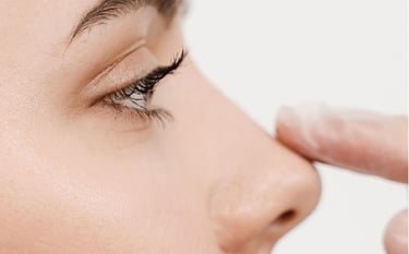 rinofiller filler naso medicina estetica a Rovereto, vicino a Trento, Bolzano, Verona