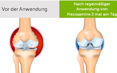 Vorteile von Flexosamine