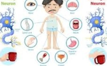 أعراض التصلب المتعدد