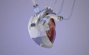 Pace Maker Device Implant Surgery: Everything About Pacemakers