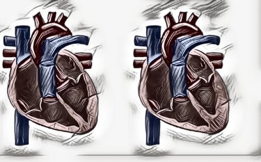 Hypertrophic Obstructive Cardiomyopathy (HOCM)  Dr. Anbarasu Mohanraj