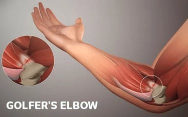 best elbow pain treatment in bangalore