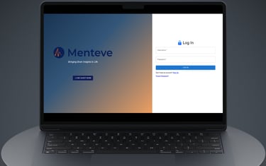 a laptop computer sitting on a table with a monitor screen