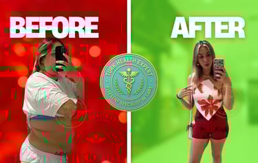 Azahara de mallorca españa en foto de antes y despues de la manga gastrica