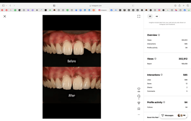 WhatsApp Business Marketing Services India – Digital With Dhana