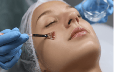 peeling facial para manchas