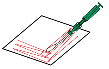 Método de hisopado (ejemplo) Kikkoman A3
