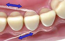 dental floss sliding motion to clean between the teeth