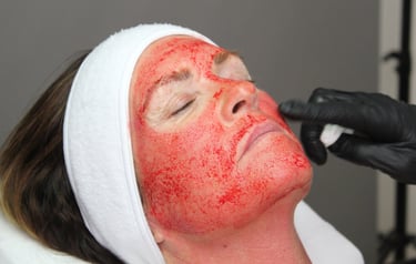 Ansigt under Vampire Facial behandling.