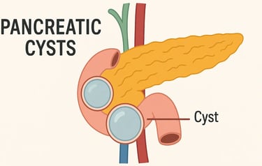 Pancreatic cysts