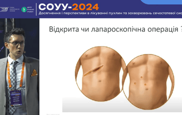 хірург-уролог, онкоуролог Олександр Стаховський, уролог, рак нирки, операції на нирці, лапароскопія