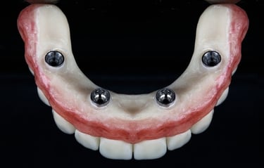 All on 4 zirconia fixed bridge