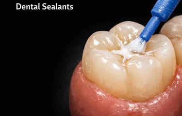 dental sealants