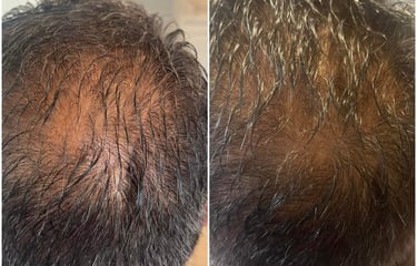 Before and after of man hair thicker