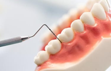 gingivite, parodontite timisoara