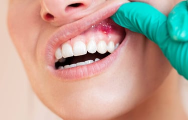 patologie orala Timisoara