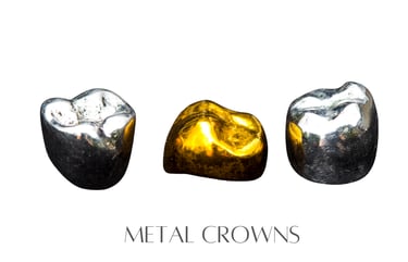 Metal Crowns