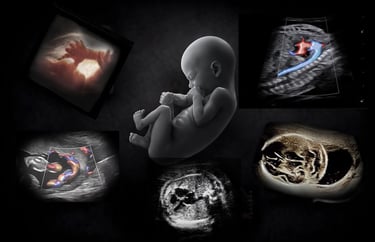 Montage of OB ultrasound images showing the findings in early, mid, and late-term pregnancy.