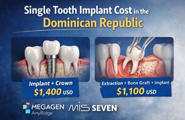 Single tooth implant cost in the Dominican Republic