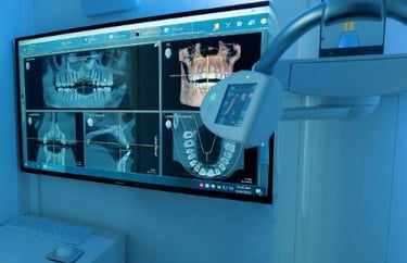 3D Ct Scan, digital dental evaluation