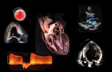 Echocardiogram diagnostic images displaying cardiac ultrasound, Doppler flow, and 3D heart anatomy.