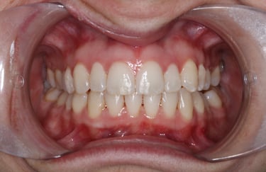 pictures of teeth
