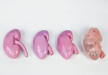Male Reproductive Organs Model