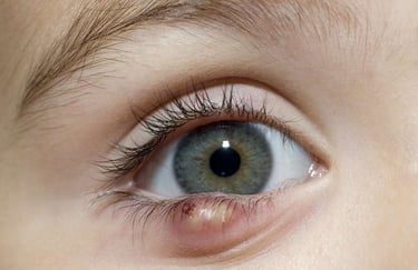 Oculoplasty