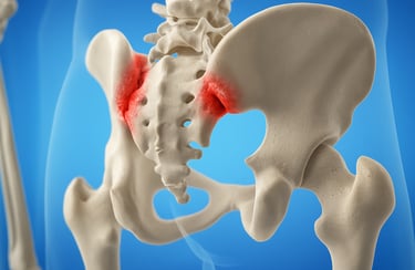 Pelvic alignment therapy for managing chronic SI joint dysfunction.