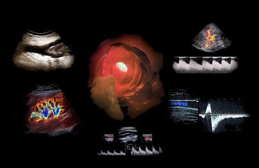 Montage of ultrasound images showing vascular disease inside the human arterial and venous systems.
