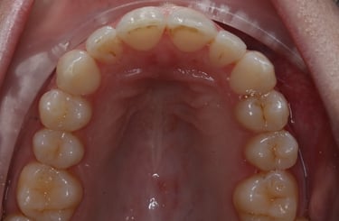 pictures of teeth