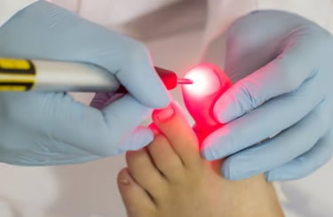 Micose nos pés | Talitha Miquelanti - Podóloga em Uberlândia | Podologia em Uberlândia