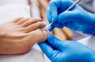 Profilaxia | Talitha Miquelanti - Podóloga em Uberlândia | Podologia em Uberlândia