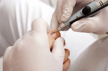 Granuloma | Talitha Miquelanti - Podóloga em Uberlândia | Podologia em Uberlândia