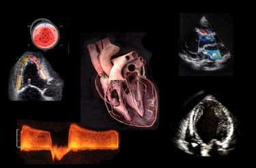 Medical collage featuring a 3D heart model, cardiac ultrasound scans, and Doppler echocardiography results.