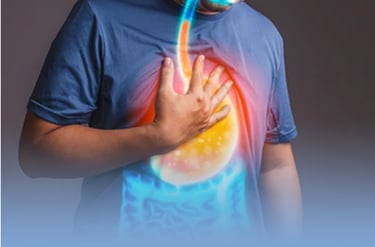 imagem que representa refluxo gastroesofágico