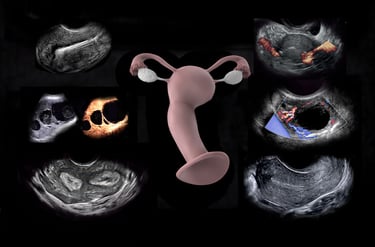 Anatomy model of the uterus and ovaries surrounded by ultrasound images of same.