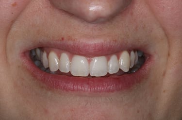 pictures of teeth
