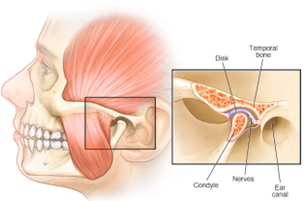 Anatomical diagram of the temporomandibular joint (TMJ) showing the condyle, disk, and nerves.