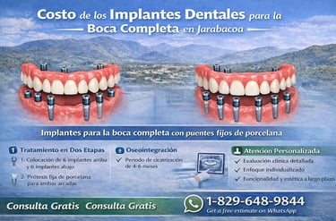 Costo de los implantes dentales para la boca completa en Jarabacoa