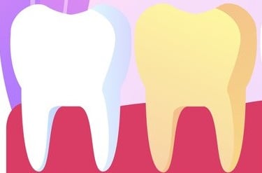 Age déminéralisation dents soins jet dentaire ozone aquolab hygiene-precision