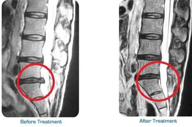 Vetrivel Health center best chiropractic and varamam theraphy 