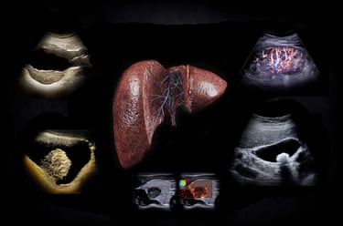 Medical illustration of a human liver surrounded by diagnostic ultrasound and doppler imaging scans.