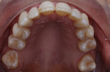 pictures of teeth