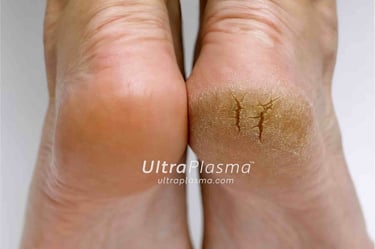 ultra_plasma_ultra_plazma_ultra-plasma_ultra-plazma