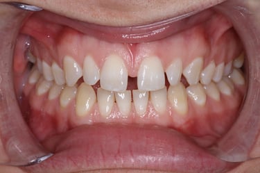 pictures of teeth