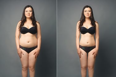 body-reshaping