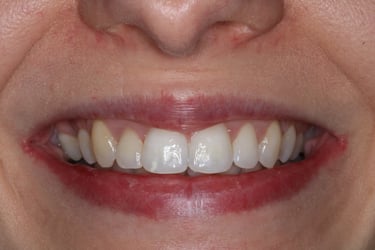 pictures of teeth