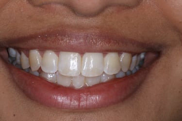 pictures of teeth
