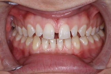 pictures of teeth